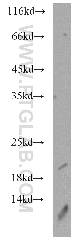 Western Blot (WB) analysis of Raji cells using SRP19 Polyclonal antibody (16033-1-AP)