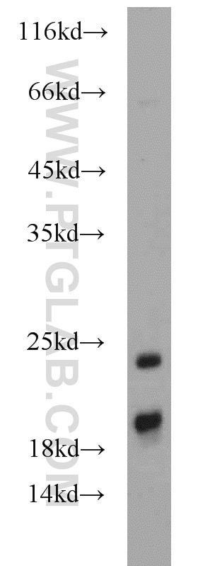 Western Blot (WB) analysis of mouse liver tissue using SRP19 Polyclonal antibody (16033-1-AP)