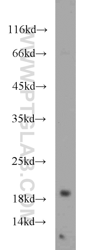 Western Blot (WB) analysis of HeLa cells using SRP19 Polyclonal antibody (16033-1-AP)