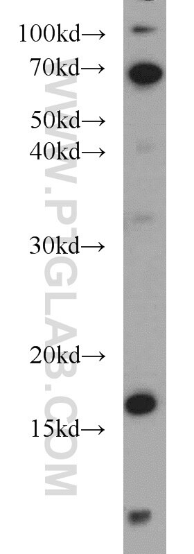 Western Blot (WB) analysis of HeLa cells using SRP19 Polyclonal antibody (16033-1-AP)
