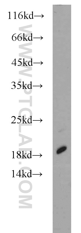 Western Blot (WB) analysis of human liver tissue using SRP19 Polyclonal antibody (16033-1-AP)