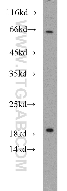 Western Blot (WB) analysis of A549 cells using SRP19 Polyclonal antibody (16033-1-AP)
