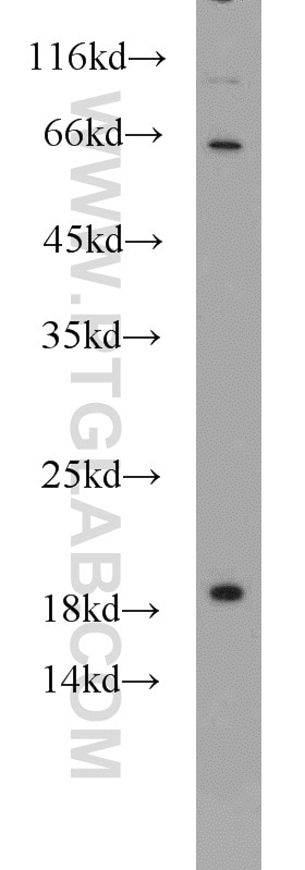 WB analysis of A549 using 16033-1-AP