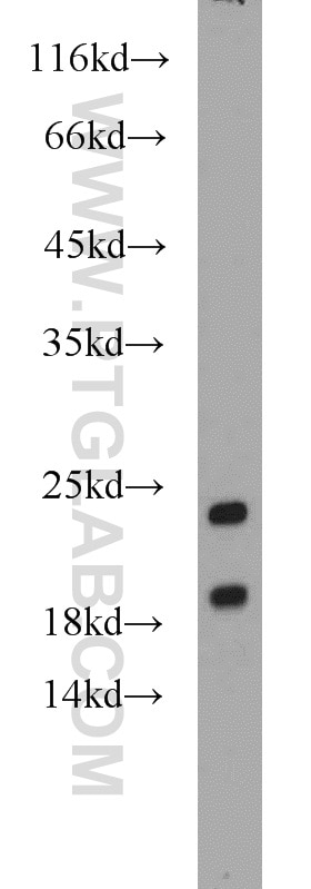 Western Blot (WB) analysis of mouse kidney tissue using SRP19 Polyclonal antibody (16033-1-AP)