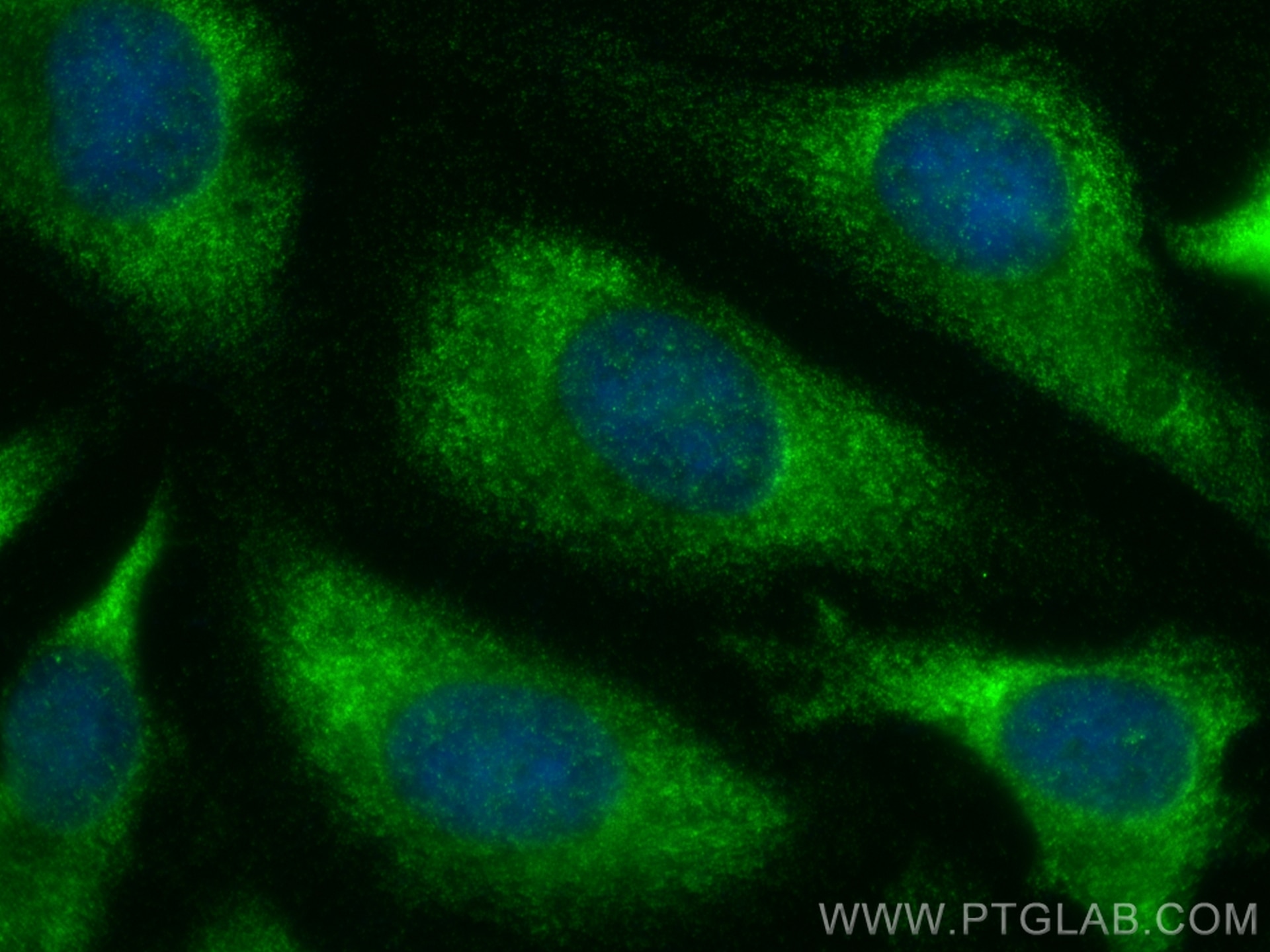 Immunofluorescence (IF) / fluorescent staining of HeLa cells using SRP19 Recombinant antibody (84061-3-RR)
