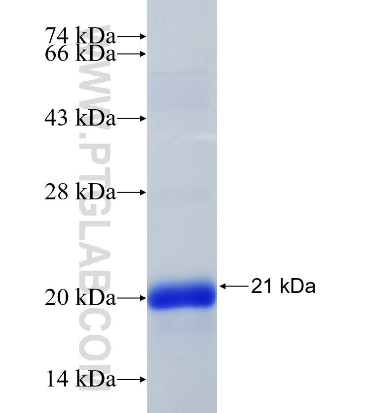 SRP19 fusion protein Ag9303 SDS-PAGE