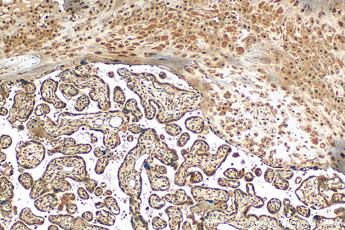 Immunohistochemistry (IHC) staining of human placenta tissue using SRP54 Polyclonal antibody (11729-1-AP)