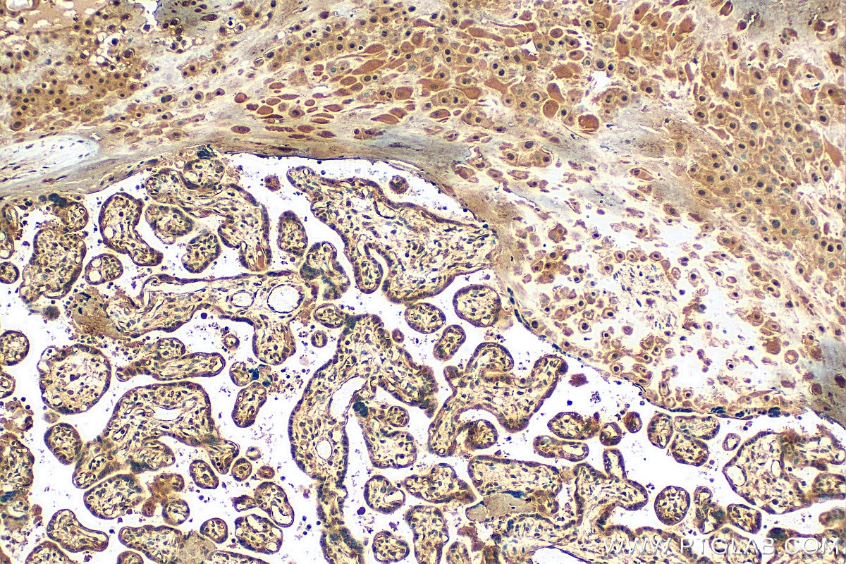 IHC staining of human placenta using 11729-1-AP