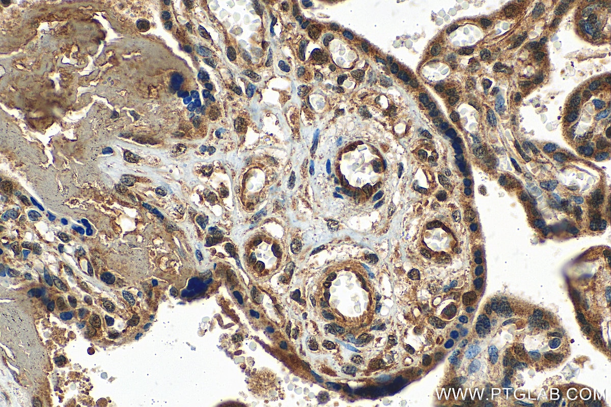 IHC staining of human placenta using 11729-1-AP