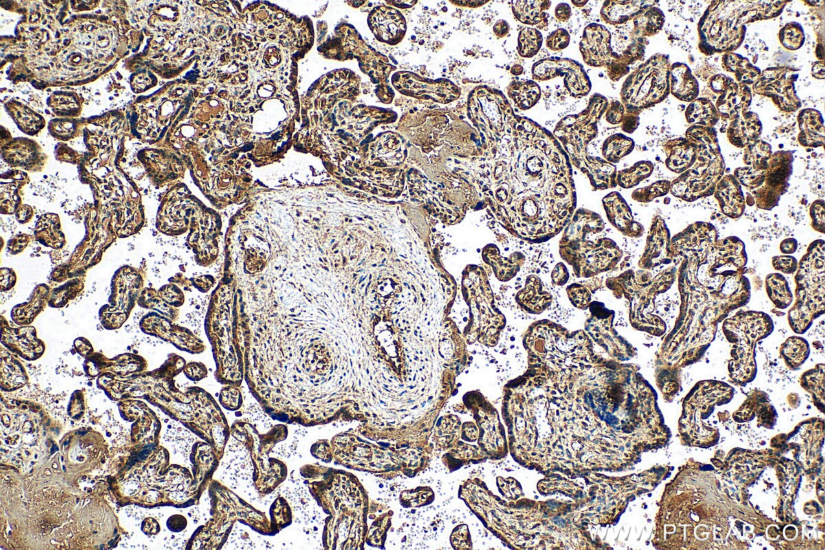 Immunohistochemistry (IHC) staining of human placenta tissue using SRP54 Polyclonal antibody (11729-1-AP)