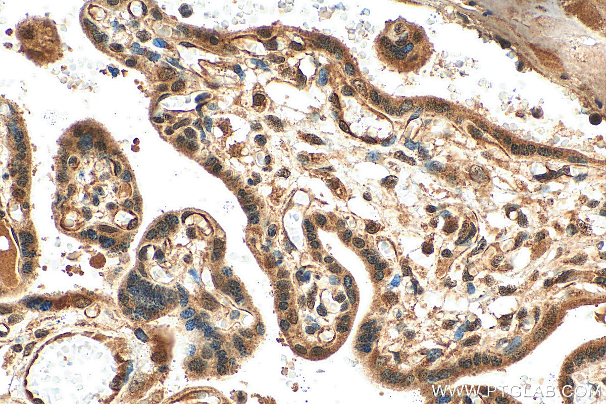 IHC staining of human placenta using 11729-1-AP