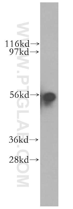 Western Blot (WB) analysis of human placenta tissue using SRP54 Polyclonal antibody (11729-1-AP)