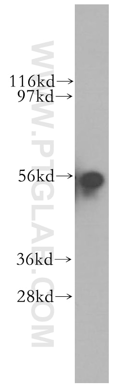 Western Blot (WB) analysis of human placenta tissue using SRP54 Polyclonal antibody (11729-1-AP)