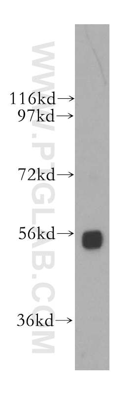 Western Blot (WB) analysis of human placenta tissue using SRP54 Polyclonal antibody (11729-1-AP)