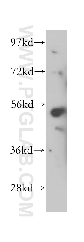 WB analysis of HeLa using 17976-1-AP