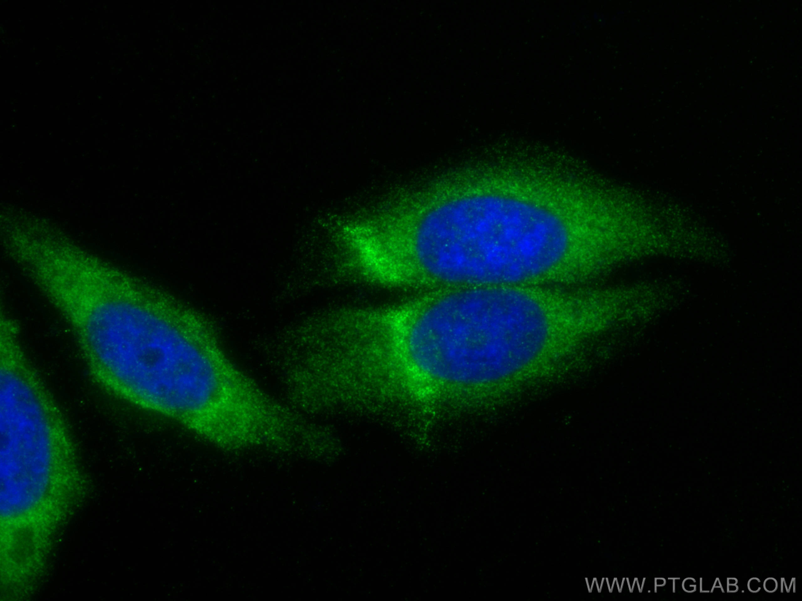Immunofluorescence (IF) / fluorescent staining of HepG2 cells using SRP68 Polyclonal antibody (11585-1-AP)