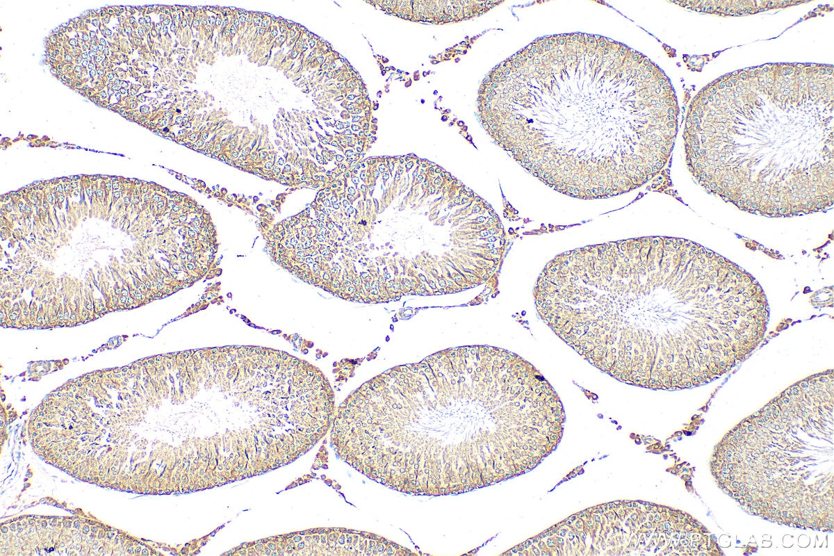 Immunohistochemistry (IHC) staining of rat testis tissue using SRP68 Polyclonal antibody (11585-1-AP)