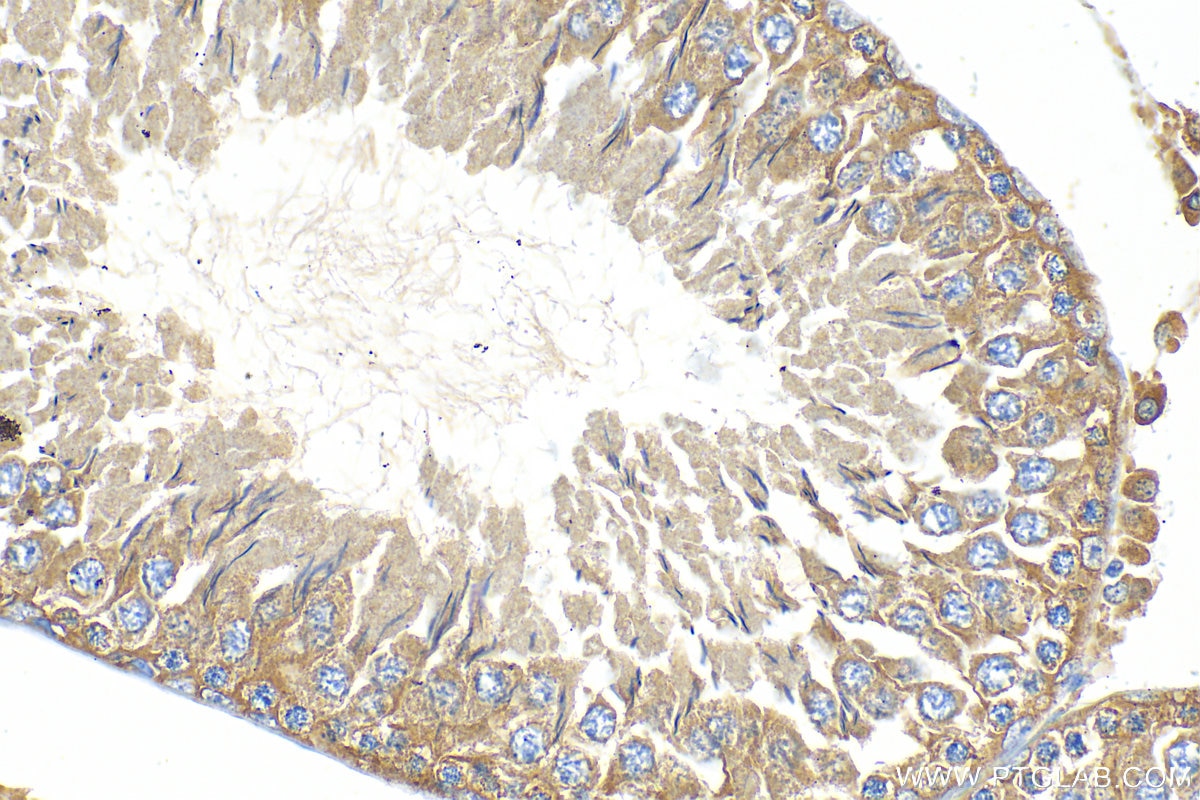 Immunohistochemistry (IHC) staining of rat testis tissue using SRP68 Polyclonal antibody (11585-1-AP)