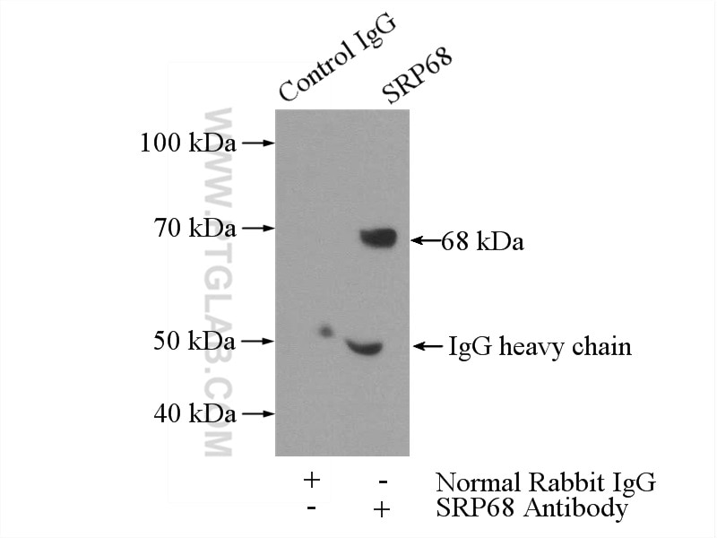 Immunoprecipitation (IP) experiment of mouse kidney tissue using SRP68 Polyclonal antibody (11585-1-AP)