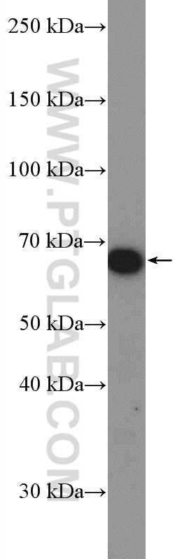 Western Blot (WB) analysis of mouse brain tissue using SRP68 Polyclonal antibody (11585-1-AP)