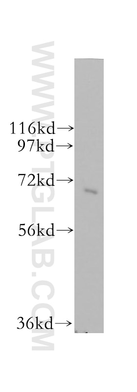 Western Blot (WB) analysis of human brain tissue using SRP68 Polyclonal antibody (11585-1-AP)