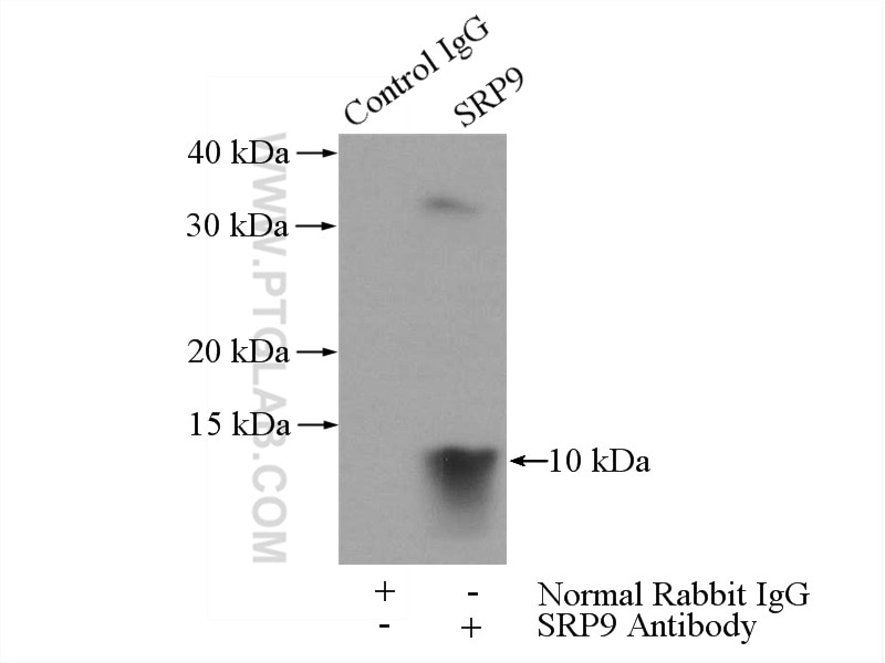Immunoprecipitation (IP) experiment of HepG2 cells using SRP9 Polyclonal antibody (11195-1-AP)