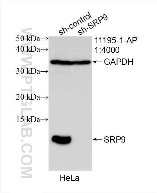 Western Blot (WB) analysis of HeLa cells using SRP9 Polyclonal antibody (11195-1-AP)