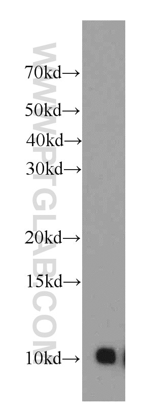 Western Blot (WB) analysis of HepG2 cells using SRP9 Polyclonal antibody (11195-1-AP)