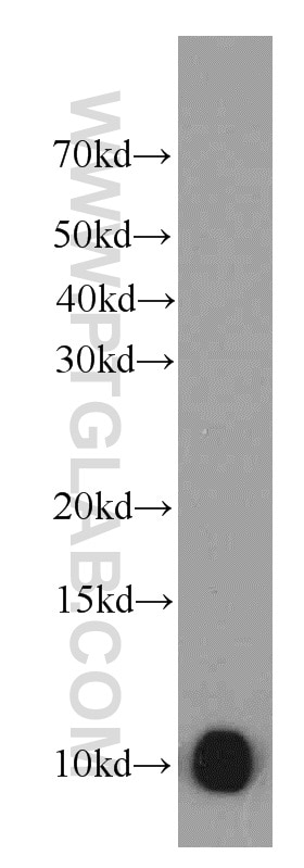 Western Blot (WB) analysis of HepG2 cells using SRP9 Polyclonal antibody (11195-1-AP)