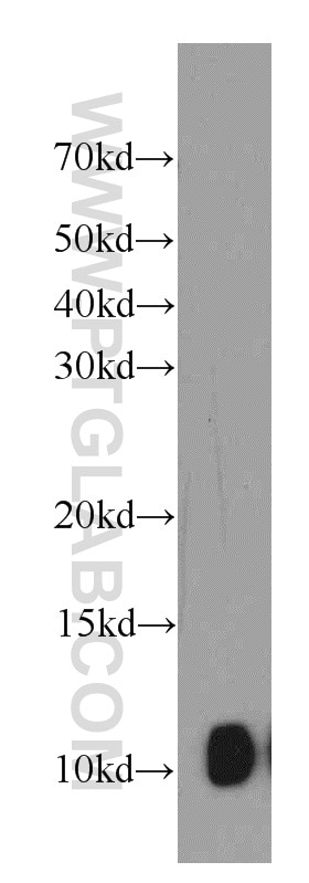 Western Blot (WB) analysis of MCF-7 cells using SRP9 Polyclonal antibody (11195-1-AP)