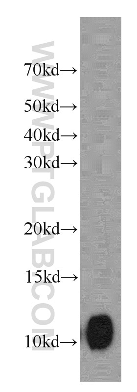 Western Blot (WB) analysis of MCF-7 cells using SRP9 Polyclonal antibody (11195-1-AP)