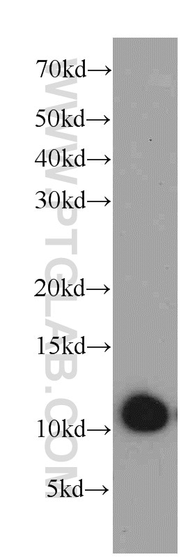 Western Blot (WB) analysis of A2780 cells using SRP9 Polyclonal antibody (11195-1-AP)