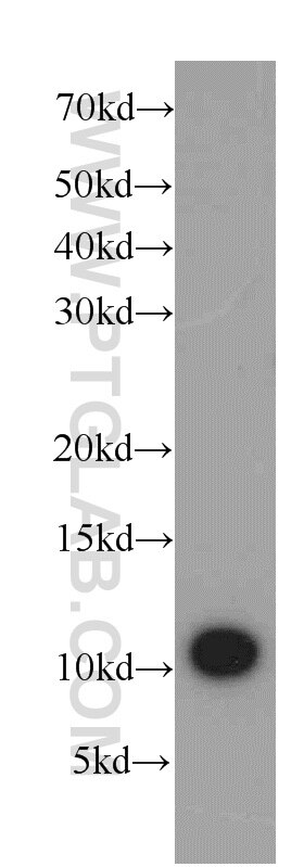 Western Blot (WB) analysis of SKOV-3 cells using SRP9 Polyclonal antibody (11195-1-AP)