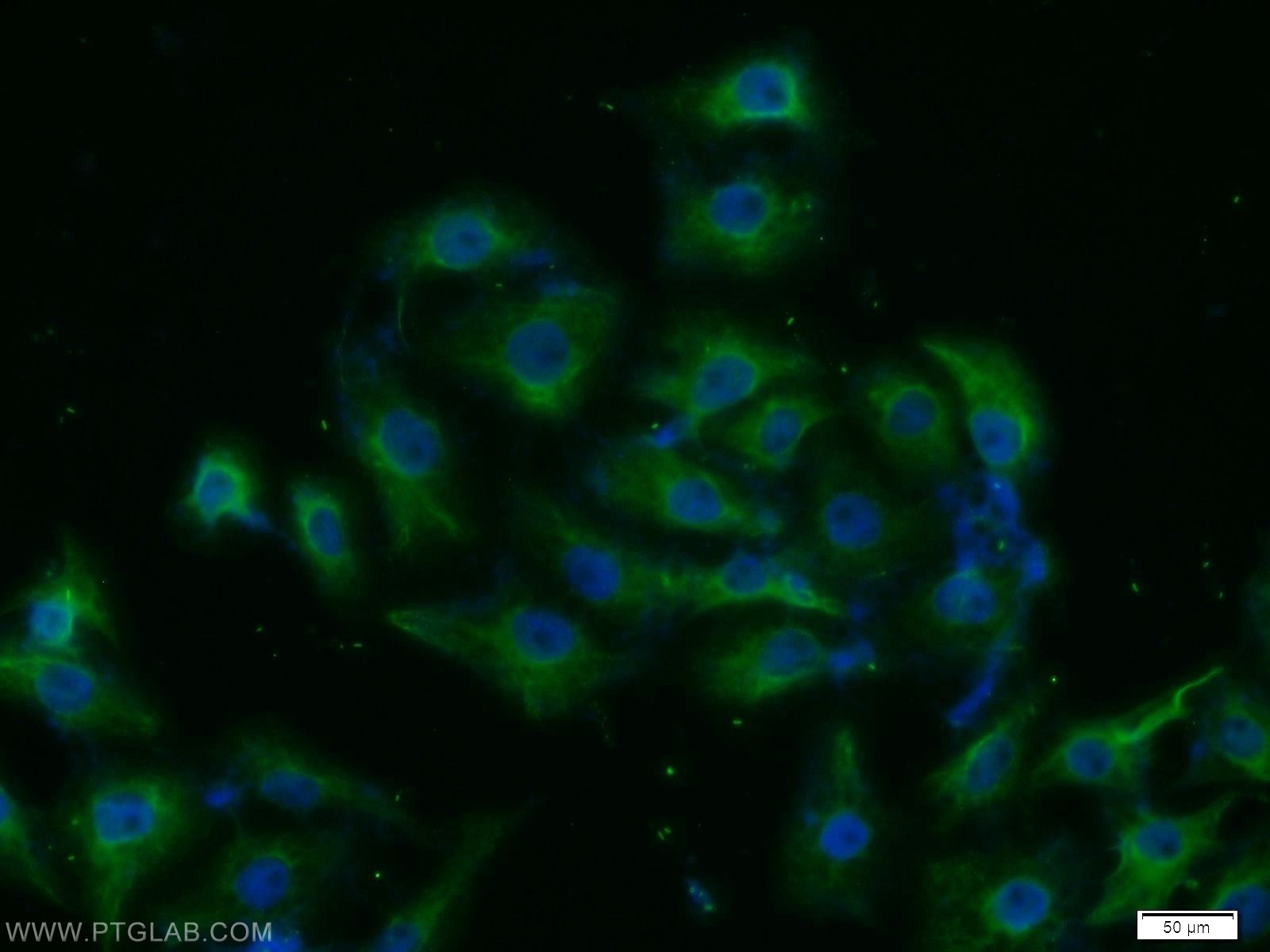 Immunofluorescence (IF) / fluorescent staining of SH-SY5Y cells using SRPK1 Polyclonal antibody (14073-1-AP)