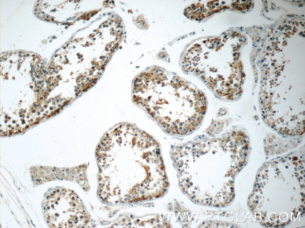 Immunohistochemistry (IHC) staining of human testis tissue using SRPK1 Polyclonal antibody (14073-1-AP)