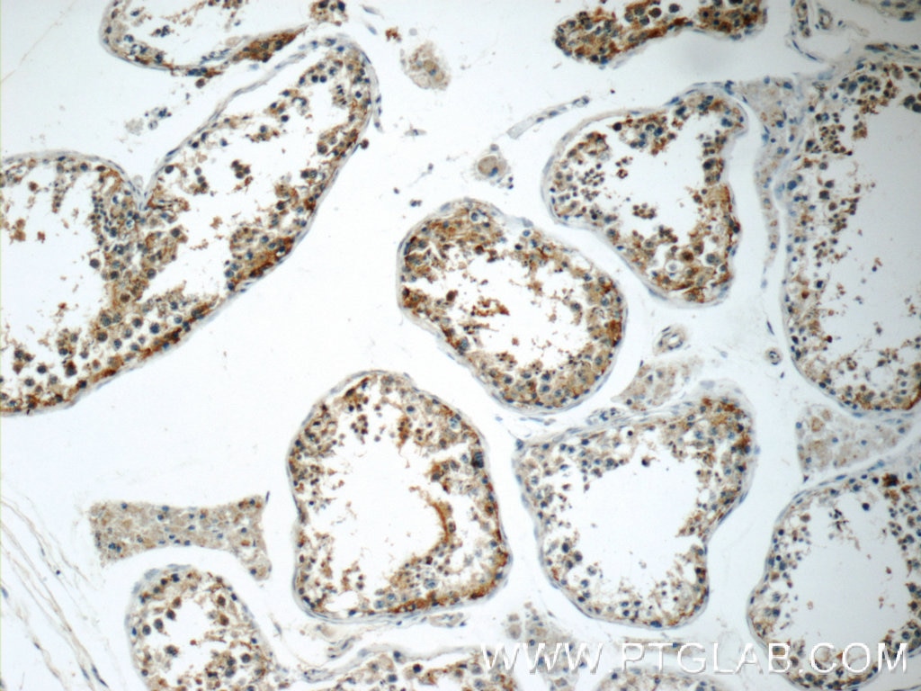 IHC staining of human testis using 14073-1-AP