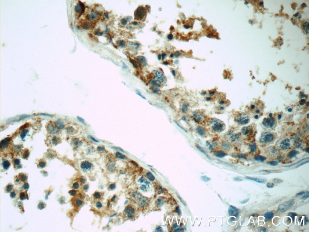 Immunohistochemistry (IHC) staining of human testis tissue using SRPK1 Polyclonal antibody (14073-1-AP)