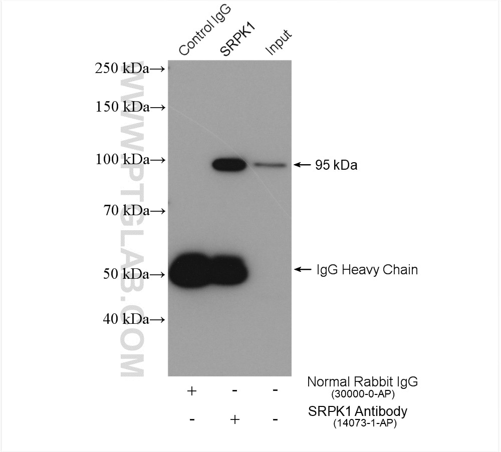 Immunoprecipitation (IP) experiment of mouse testis tissue using SRPK1 Polyclonal antibody (14073-1-AP)