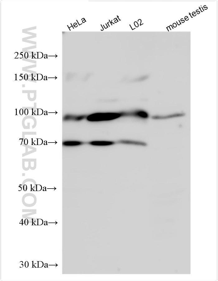 Western Blot (WB) analysis of various lysates using SRPK1 Polyclonal antibody (14073-1-AP)