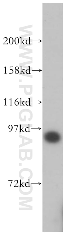 Western Blot (WB) analysis of Jurkat cells using SRPK1 Polyclonal antibody (14073-1-AP)