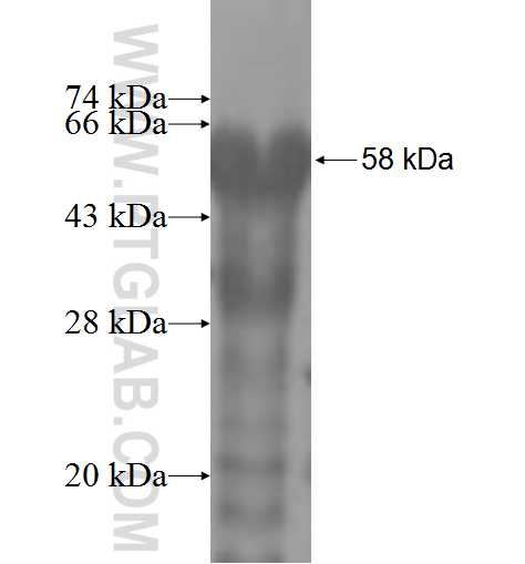SRPK1 fusion protein Ag5149 SDS-PAGE