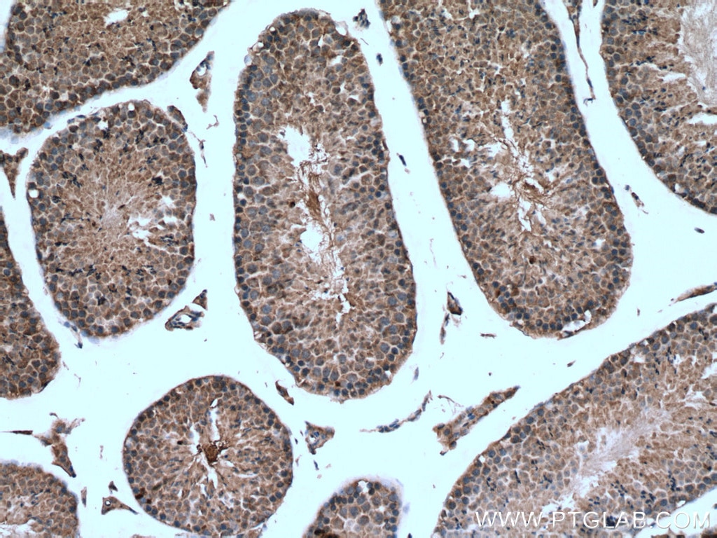 Immunohistochemistry (IHC) staining of mouse testis tissue using SRPK2 Polyclonal antibody (25417-1-AP)