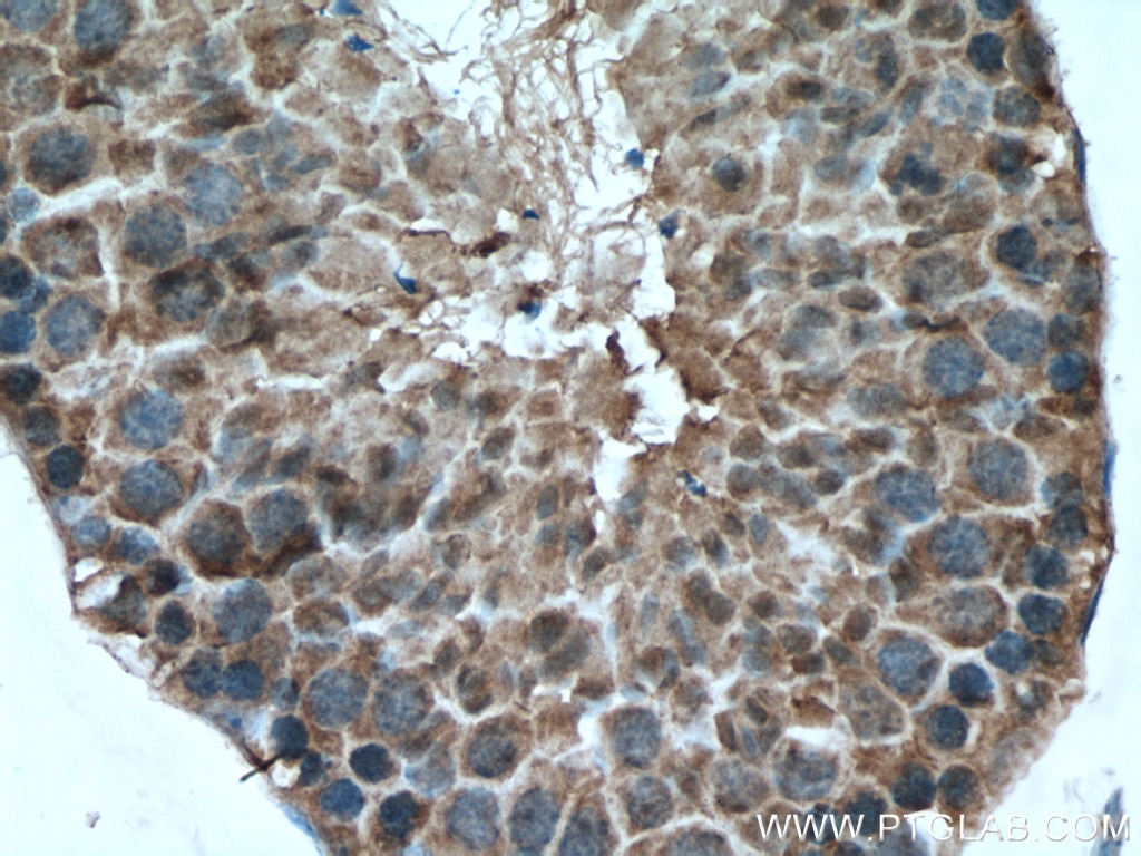 Immunohistochemistry (IHC) staining of mouse testis tissue using SRPK2 Polyclonal antibody (25417-1-AP)