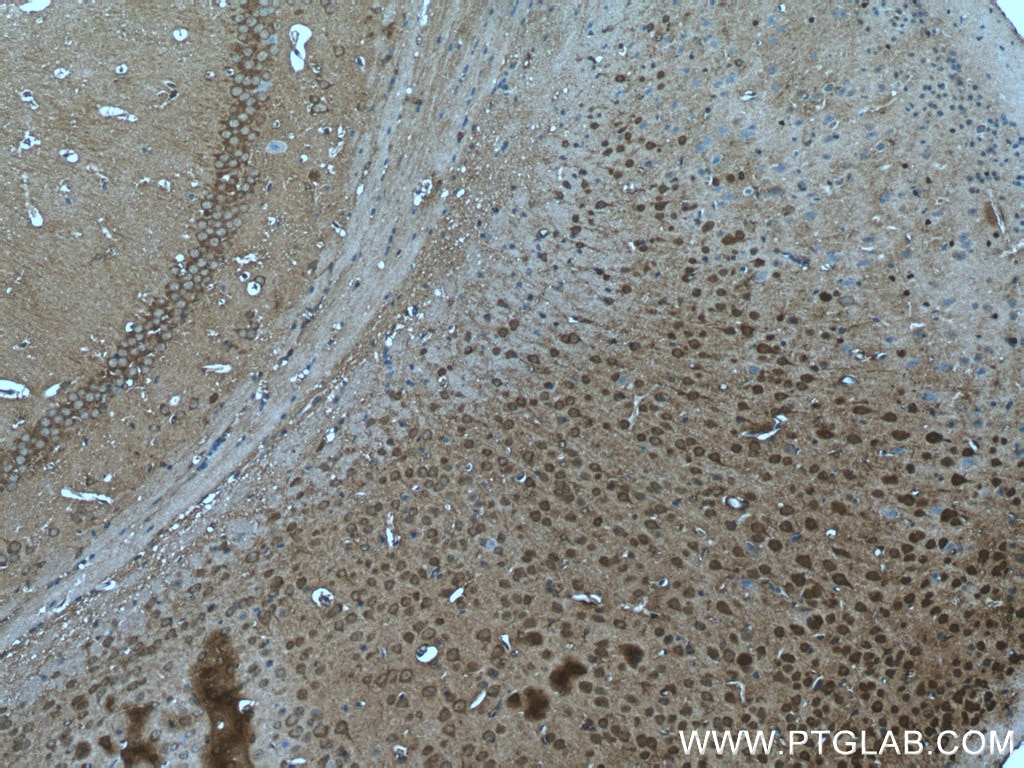 Immunohistochemistry (IHC) staining of mouse brain tissue using SRPK2 Polyclonal antibody (25417-1-AP)