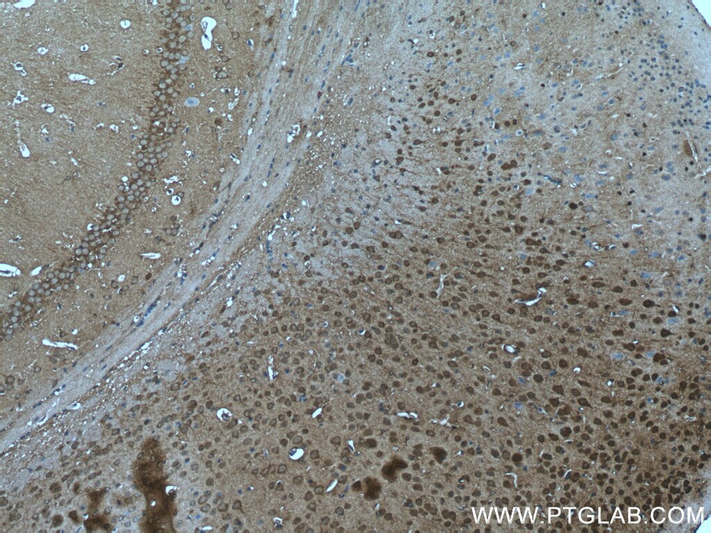 IHC staining of mouse brain using 25417-1-AP