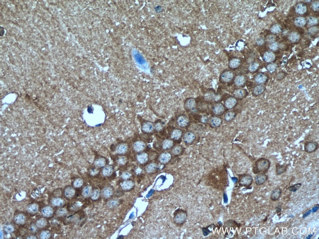 Immunohistochemistry (IHC) staining of mouse brain tissue using SRPK2 Polyclonal antibody (25417-1-AP)