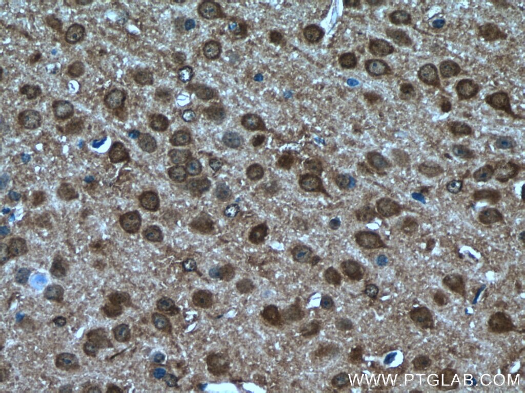 Immunohistochemistry (IHC) staining of mouse brain tissue using SRPK2 Polyclonal antibody (25417-1-AP)