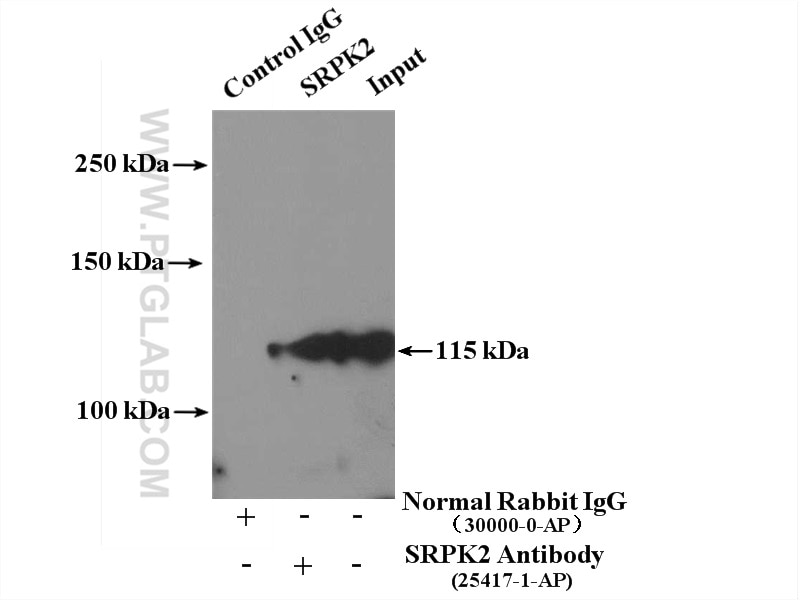 Immunoprecipitation (IP) experiment of HeLa cells using SRPK2 Polyclonal antibody (25417-1-AP)