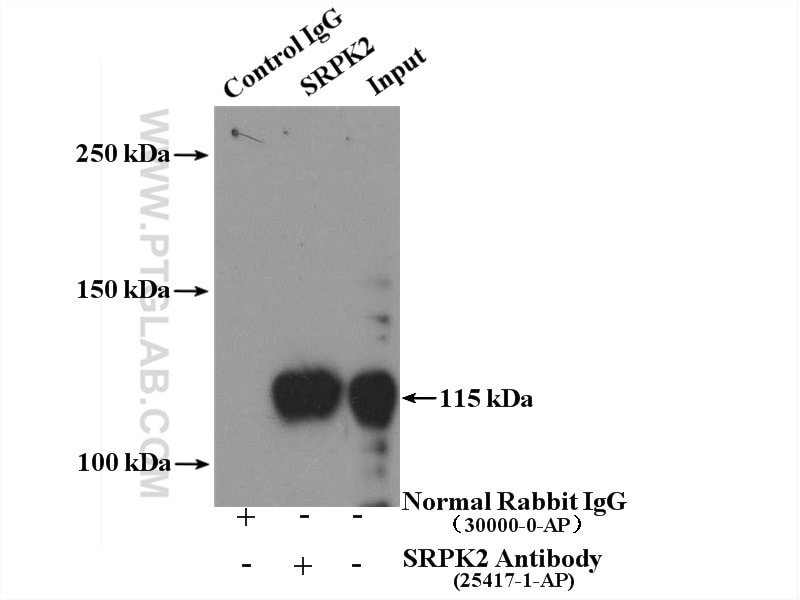 Immunoprecipitation (IP) experiment of HeLa cells using SRPK2 Polyclonal antibody (25417-1-AP)