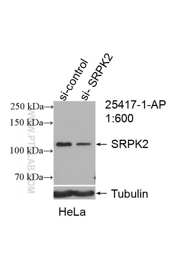 Western Blot (WB) analysis of HeLa cells using SRPK2 Polyclonal antibody (25417-1-AP)